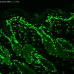 Acetylated Lysine (monoclonal, clone 7F8) in the group Antibodies Plant/Algal / DNA/RNA/Cell Cycle / Translation at Agrisera AB (Antibodies for research) (AS10 707-100)